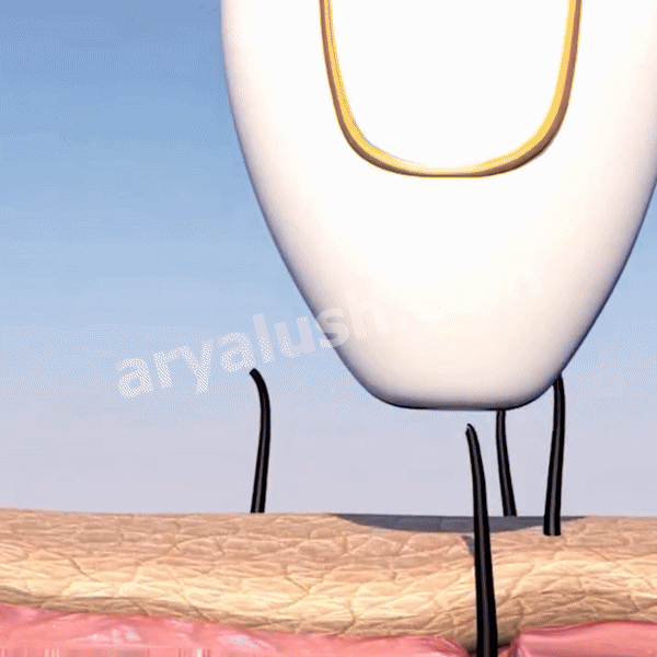 IPL Pulse • Permanent Hair Removal Device