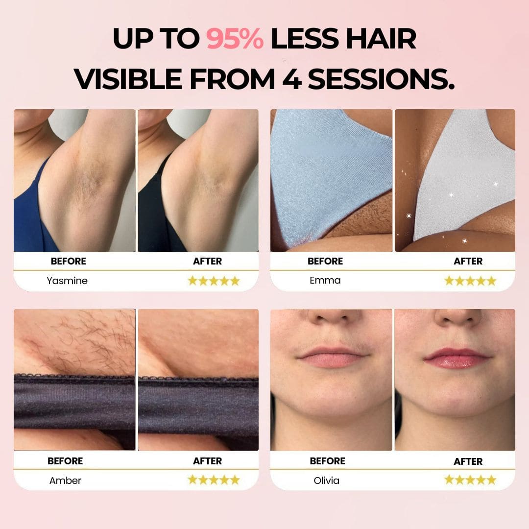 IPL Pulse • Permanent Hair Removal Device